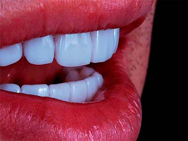 odontologia estetica-salina cruz