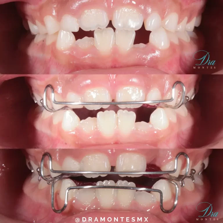 ortopedia dentomaxilofacial salina cruz